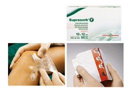 SUPRASORB F Film 10x12 10pz