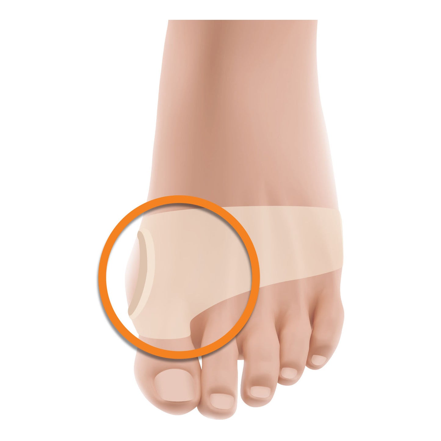 FASCIA PROT ALLUCE VALGO GEL M