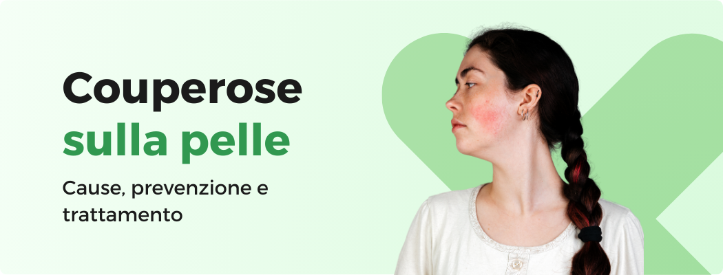 COUPEROSE: PREVENZIONE E TRATTAMENTO PER LA TUA PELLE