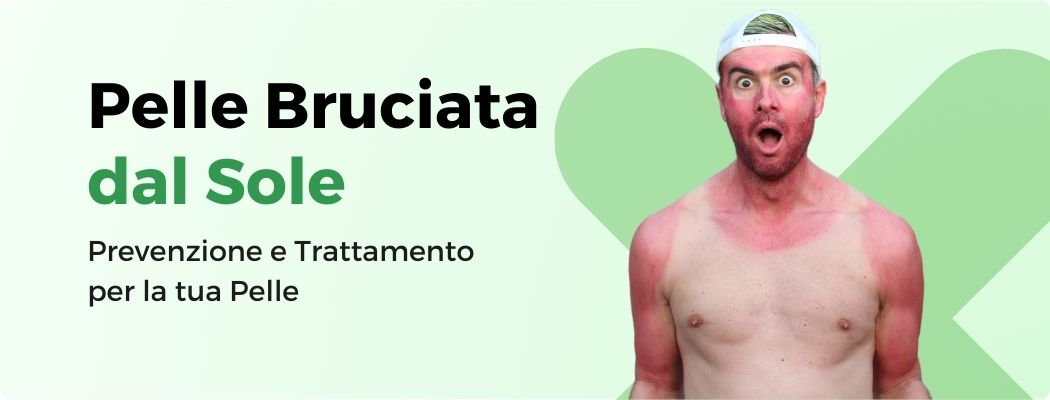 PELLE BRUCIATA DAL SOLE: COME NON SCOTTARSI IN ESTATE