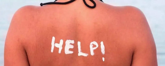 PELLE BACIATA DAL SOLE? ATTENZIONE