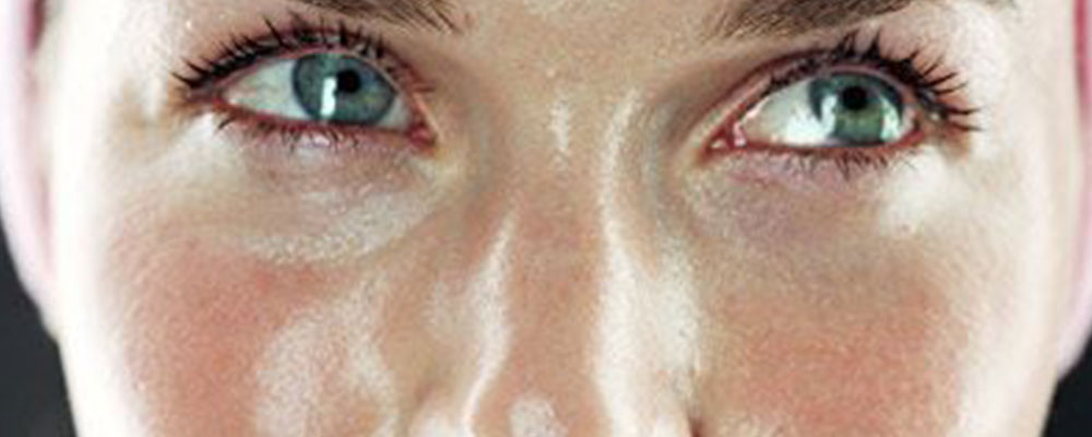 RIMEDI PER LA PELLE GRASSA