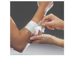OPSITE Flexifix cm10x10mt 1pz