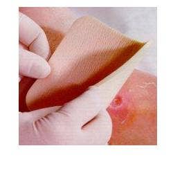 ALLEVYN 3 Medic.N-Ades.cm20x20