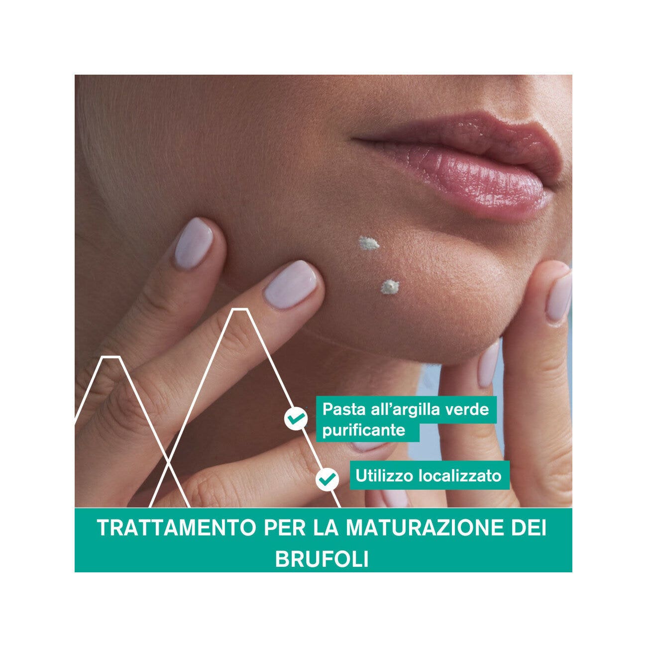 Uriage Hyséac Pasta SOS 15g