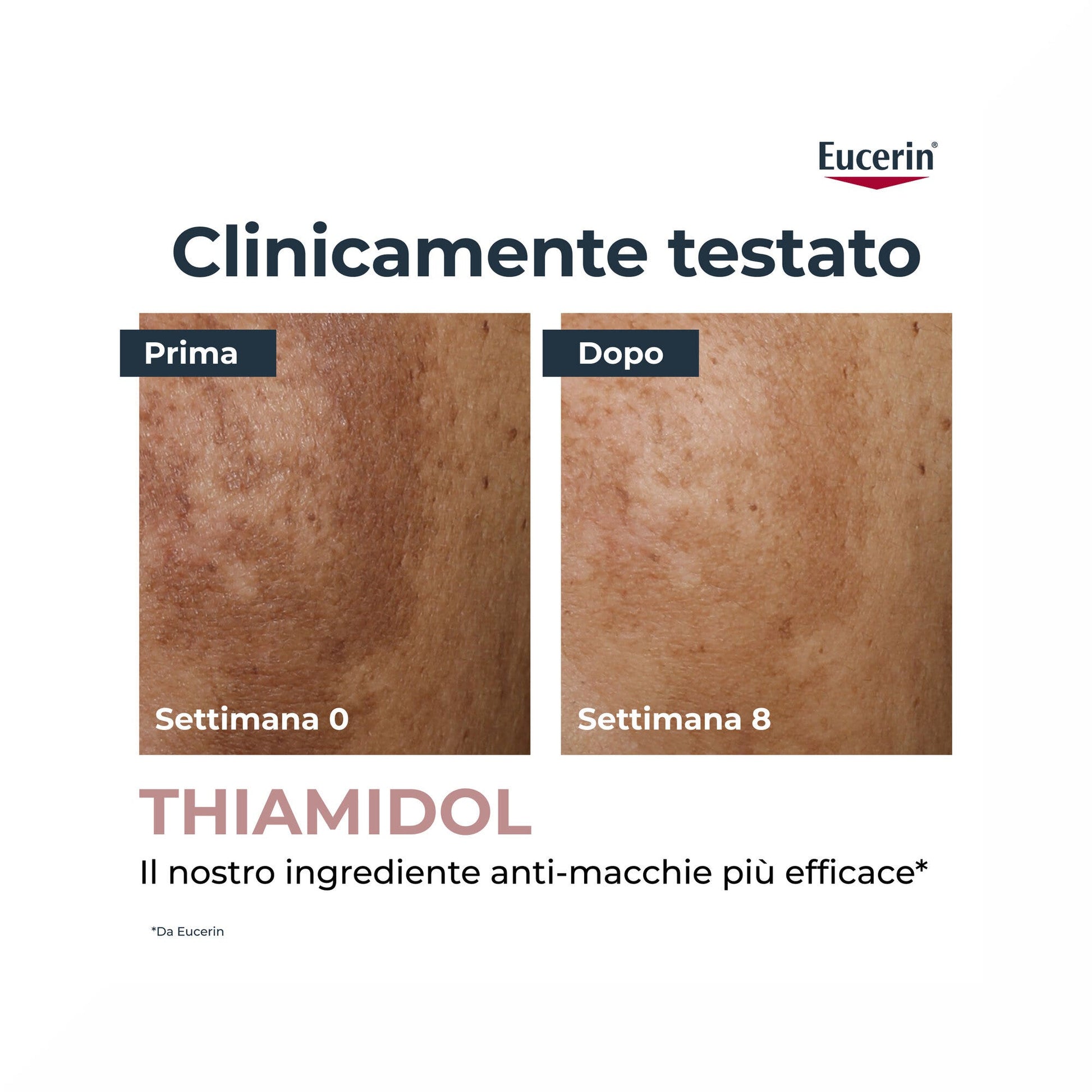 Eucerin Anti-Pigment Siero Illuminante Anti-Macchie 30ml